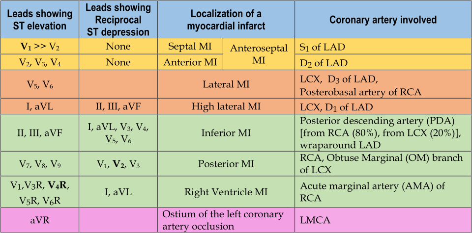 Electrocardiography in myocardial infarction - Wikipedia